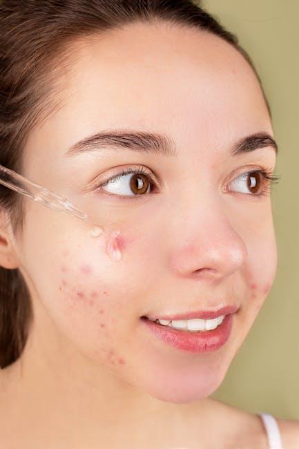 Understanding the ⁣Causes of Acne